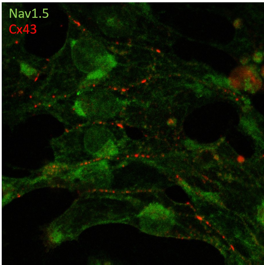 project4 Afbeelding7