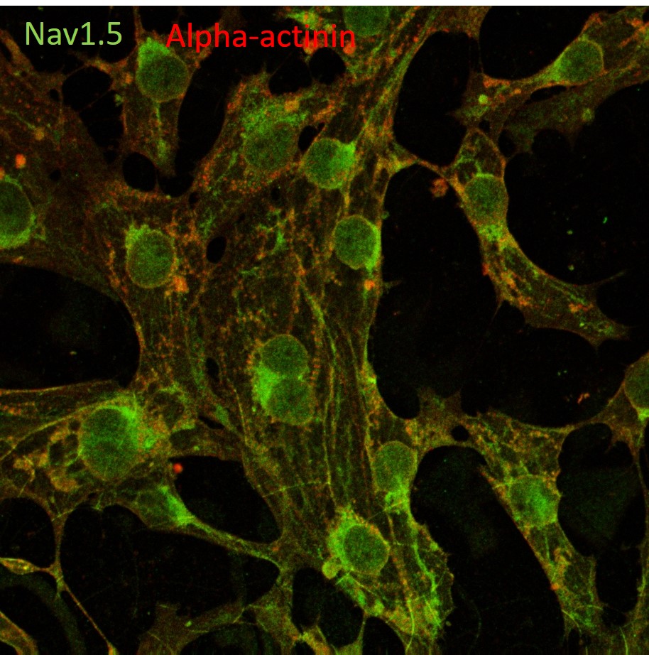 project4 Afbeelding8